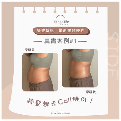 FT 擊脂纖形2a2.jpg