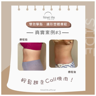 FT 擊脂纖形2c2.jpg