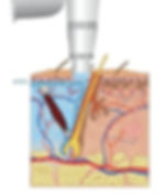 dermaoxy