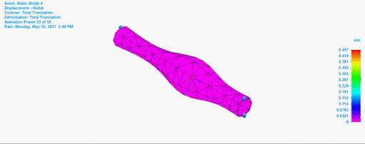 stent gif.gif