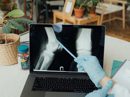 Osteogenesis Imperfecta Treatment Options in Türkiye: A Path to Improved Mobility and Quality of Life