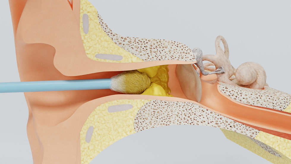 Microsuction Ear Wax Removal at MK Ear Wax Clinic