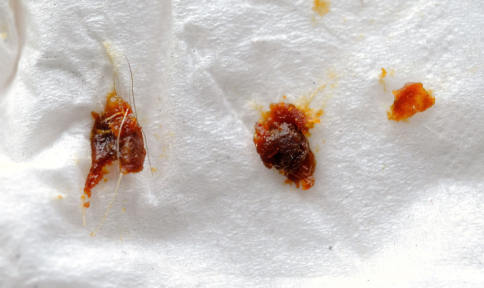 Image showing lumps of wax