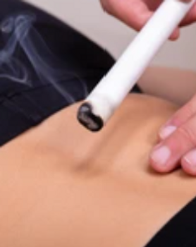 Moxa Behandlung mit Cellstark in Zürich
