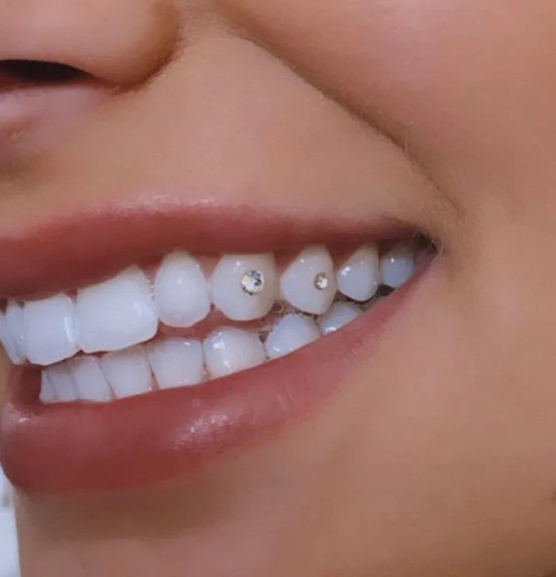 tooth gem.webp