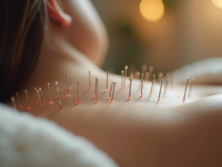 Similarities and Differences in Acupuncture and Dry Needling