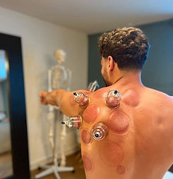 massage-cupping-therapy-geneve-lausanne-fribourg.jpeg