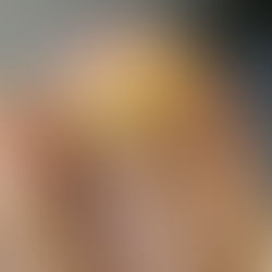 Home treatments for onychomycosis are they any good?