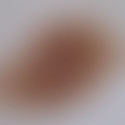 Seeing the light - the rise of dermoscopy in dermatology