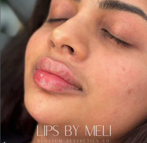 Voted Best Medspa in Wake Forest, Raleigh and Durham, NC