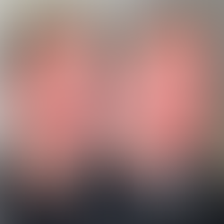 Kybella in Raleigh, NC: Non-Surgical Double Chin Reduction Explained