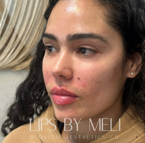 Voted Best Medspa in Wake Forest, Raleigh and Durham, NC