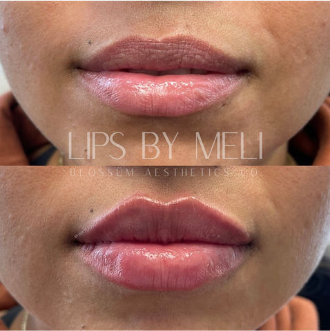 Voted Best Medspa in Wake Forest, Raleigh and Durham, NC