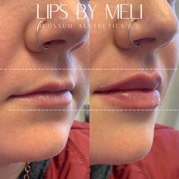 Voted Best Medspa in Wake Forest, Raleigh and Durham, NC