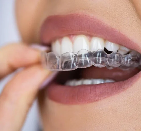 We straighten teeth using comfortable, removable clear aligners like Invisalign