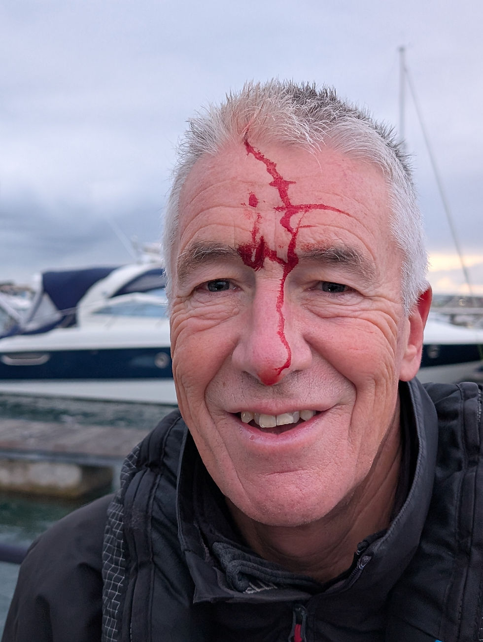 Mark with blood running down his face