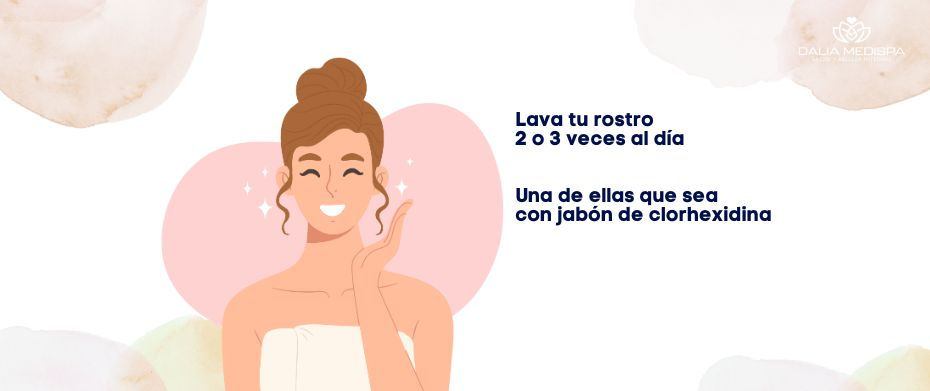 Tratamiento de acné