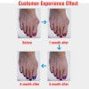 Thumbnail: Bunion Corrector Silicone Toe Sleeves and Separator