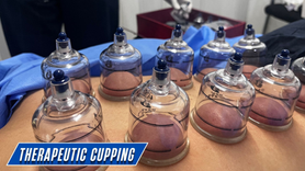 Therapeutic cupping treatment for muscle tension and pain management