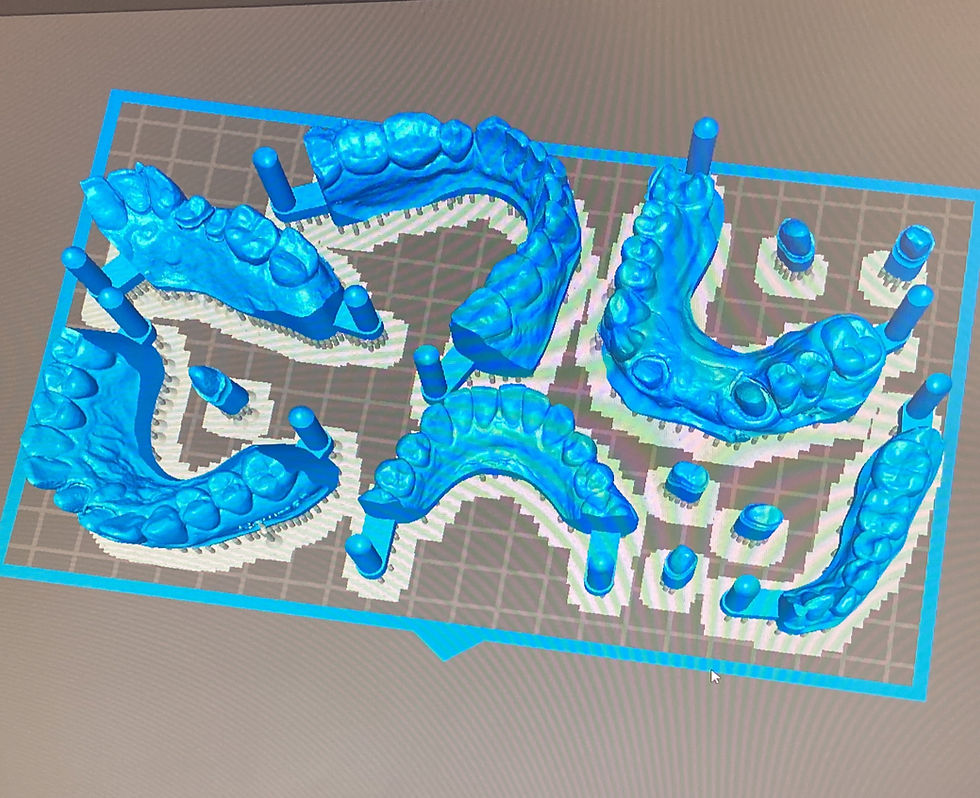 Enhancing Dentist-Lab Communication Through Local Crown and Bridge Labs