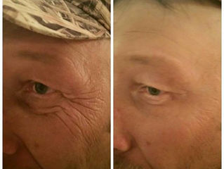 ¡¡Nuestros testimonios con Instantly Ageless!!
