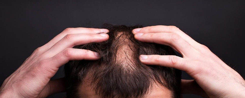 Hairland kocaeli protez saç