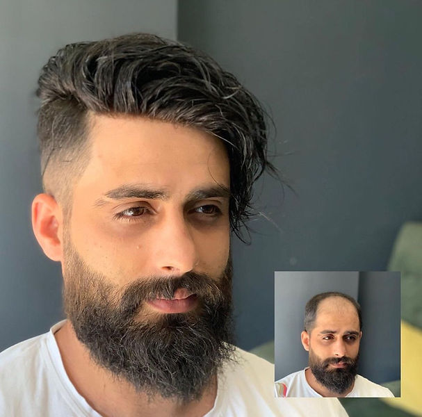 Toupee human hair pieces for men free shipping.jpeg