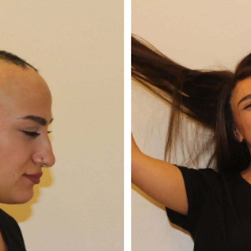 kocaeli bayan protez saç