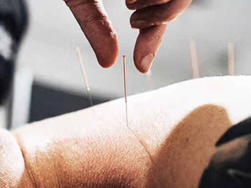 Acupuncture sportive à Montréal : récupération et prévention des blessures