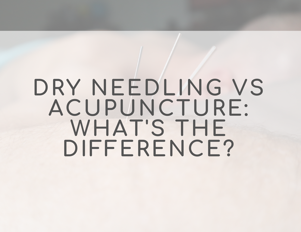 Dry needling vs Acupuncture What is the difference?
