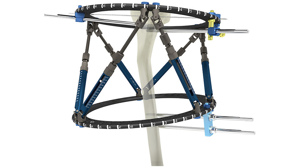 Smart Fixator