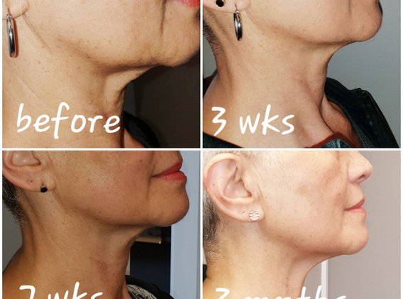 Untitled design - 2019-08-06T110637.333.