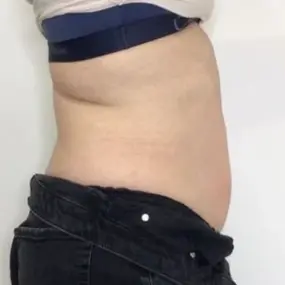 Side profile of a person with their shirt lifted slightly, revealing their midsection