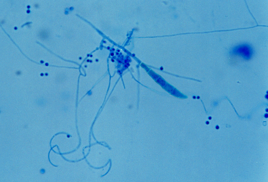 Trychophyton mentagrophytes