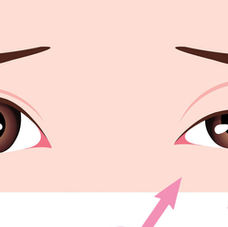 Why Does My Eye Keep Twitching?