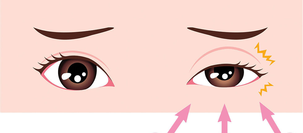 Why Does My Eye Keep Twitching?