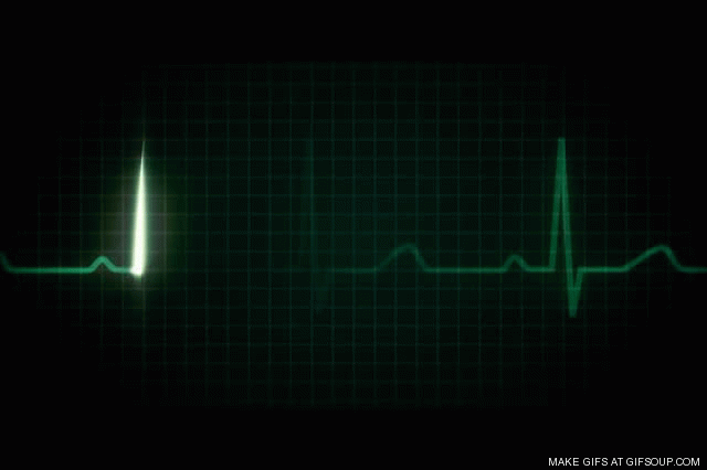 ECG, EKG