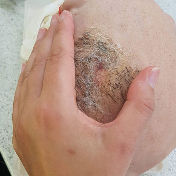 Casualty prosthetics 03.jpeg