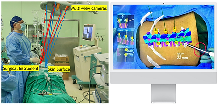 Multi-View Mark-Less Surgical Navigation System.png