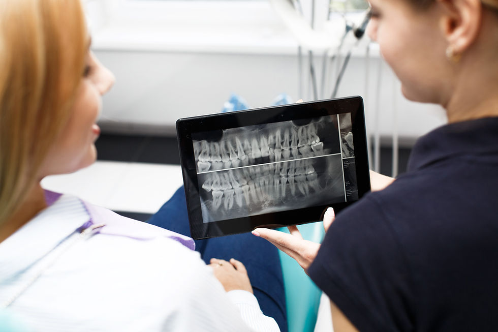 dental digital x-ray