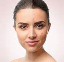 rejuvenating Glycolic Peel