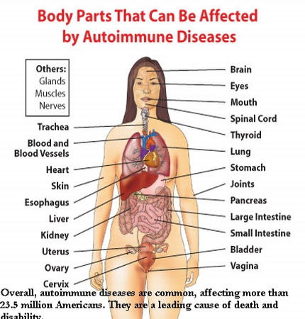 Body parts that can be affected by autoimmune diseases