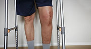 knee_replacement_edited.jpg