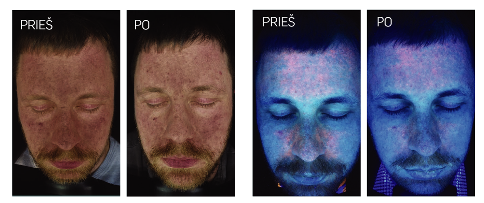 PRIESPO3.png