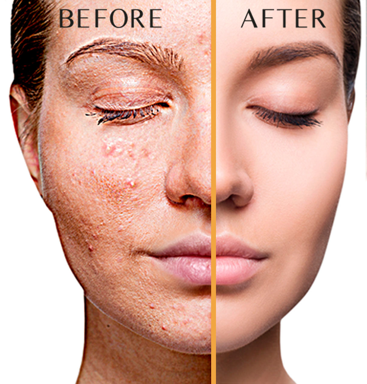 VELFORM COVER FACE COVERAGE