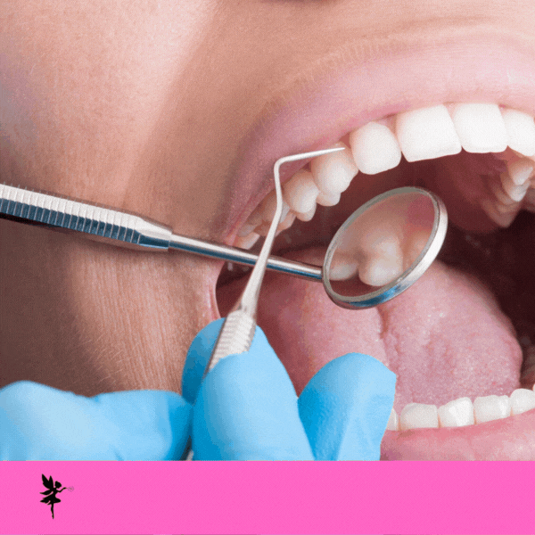 Scaling Debridement (Cleanings)