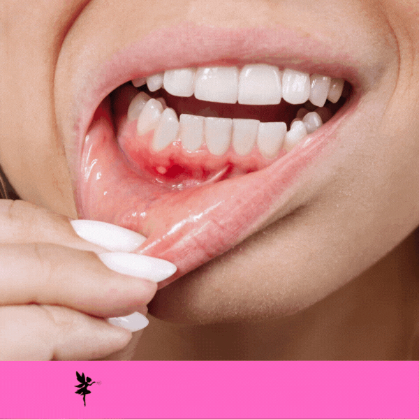 Oral Cancer Screening