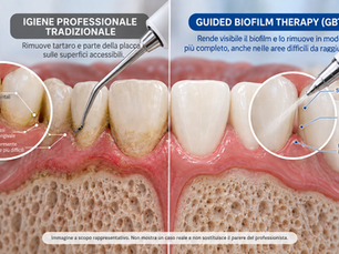 Igiene orale professionale e Guided Biofilm Therapy (GBT): come funziona e quando può essere utile