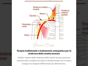Terapia tradizionale e trattamento osteopatico per la sindrome dello stretto toracico