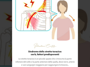Sindrome dello stretto toracico: cos’è, fattori predisponenti